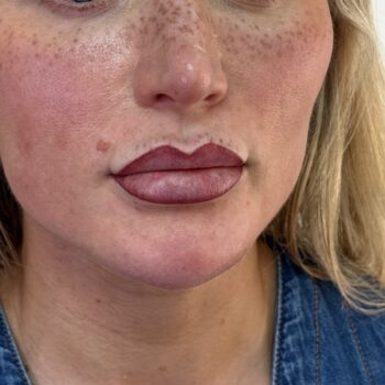 Healed faux freckles and ombre lip blush leeds pmu